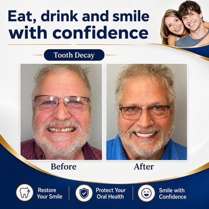 🔥Ends Today: 70% OFF! 🏆2026 Bestselling Product🔥 Fit for a Fresh Smile, Say Goodbye to Wearing Discomfort!🌎