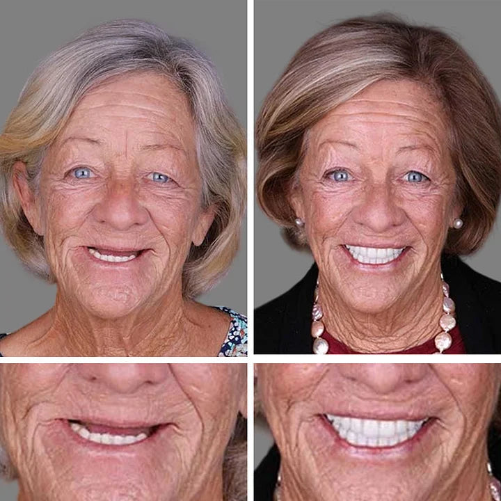 🔥Ends Today: 70% OFF! 🦷 Designed for Comfort and a Natural-Looking Smile Designed for Comfort and a Natural-Looking Smile & FDA-Certified
