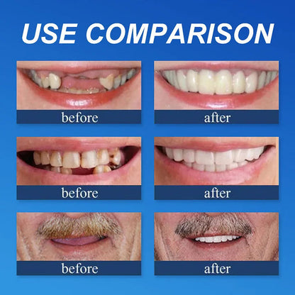 🌎Ends Today: 75% OFF! 🦷 Designed for Comfort and a Natural-Looking Smile