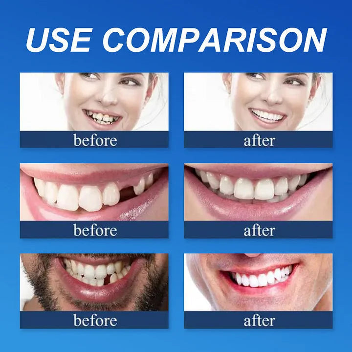🌎Ends Today: 75% OFF! 🦷 Designed for Comfort and a Natural-Looking Smile